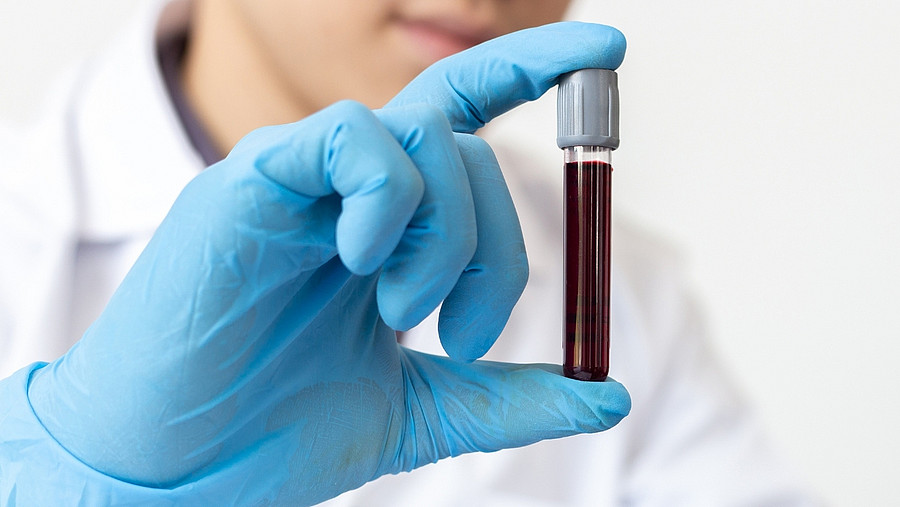 Illsutration PM Publikation Nature Communications